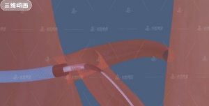 精準(zhǔn)醫(yī)療與 3D 模型，相輔相成的得力助手?